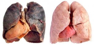 smoker's lungs and healthy
